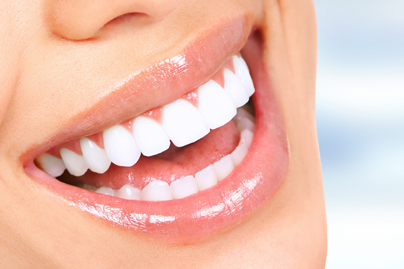 Cosmetic Dentistry in Lakeview