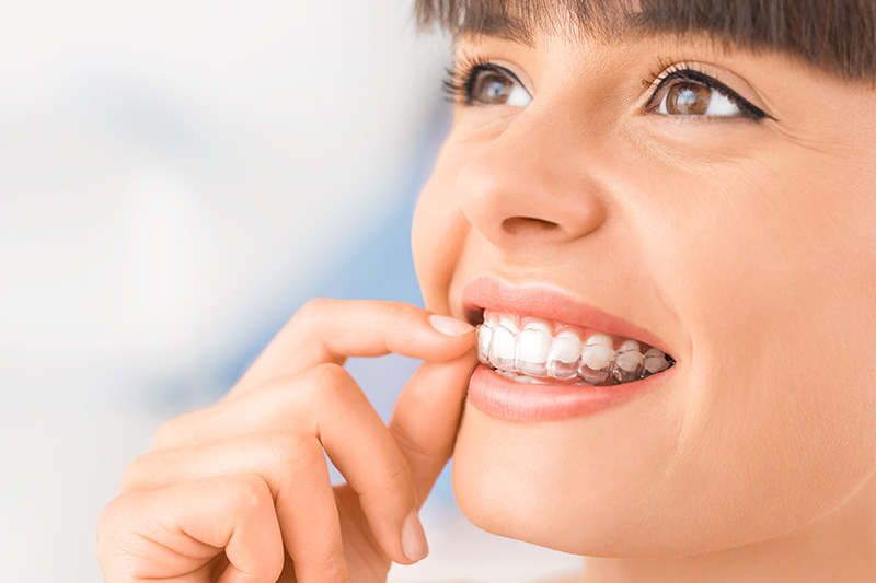 Invisalign in Lakeview